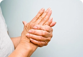 Deformidad en las manos